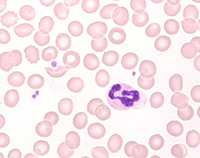 RAPID STAINING OF BLOOD SMEAR SOLUTION 1